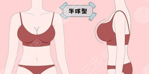 羅盛康隆胸案例圖