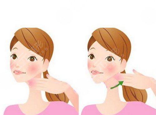  北京佰華利醫(yī)美面部吸脂案例