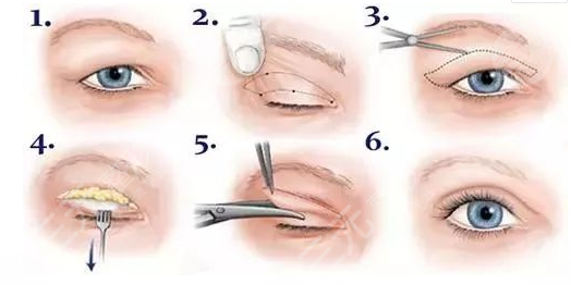 蘭大二院整形科價(jià)格表2021新版，醫(yī)生簡介|雙眼皮修復(fù)案例