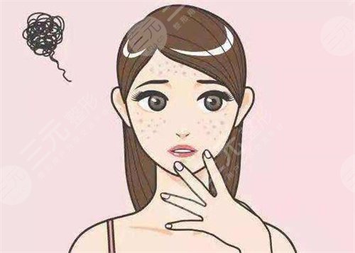 湖南中醫(yī)附一祛斑案例后