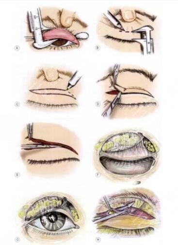 長(zhǎng)得不好看的我