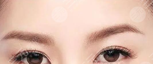 眉毛種植