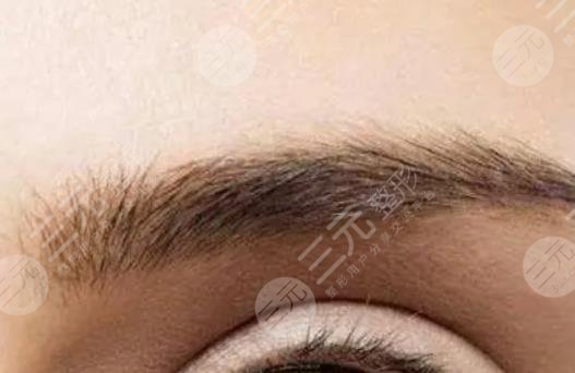 種植眉毛