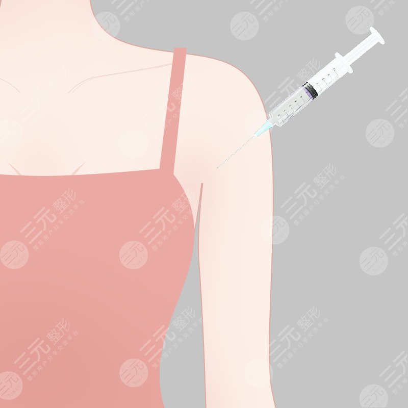 手臂微創(chuàng)溶脂果圖對比