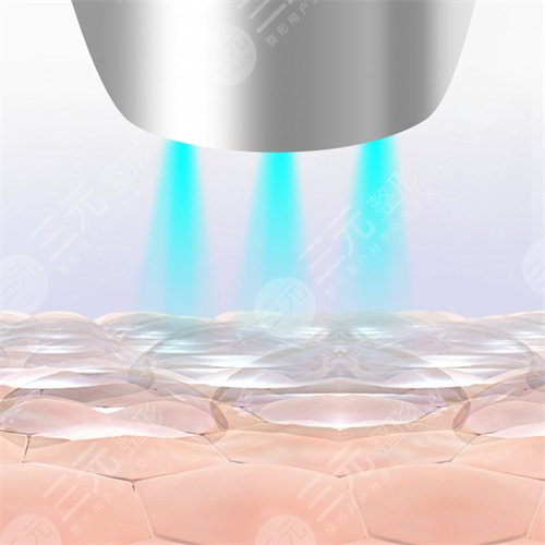 臉上紅血絲如何去除？怎么修復(fù)？注意事項