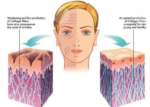深藍(lán)射頻的適應(yīng)癥都有哪些?