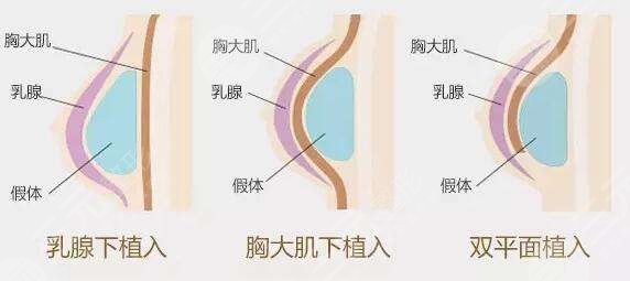 娜綺麗和傲諾拉哪款好？