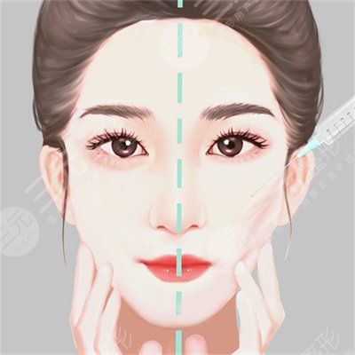 膠原光多久做一次