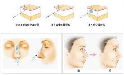 提升抗皺面部抗衰能保持多久