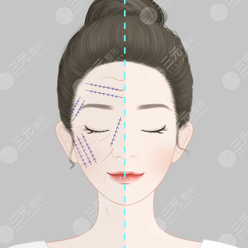 福州熱瑪吉果反饋