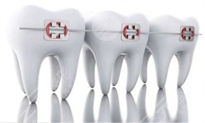 洛陽(yáng)牙大夫矯正牙齒案例