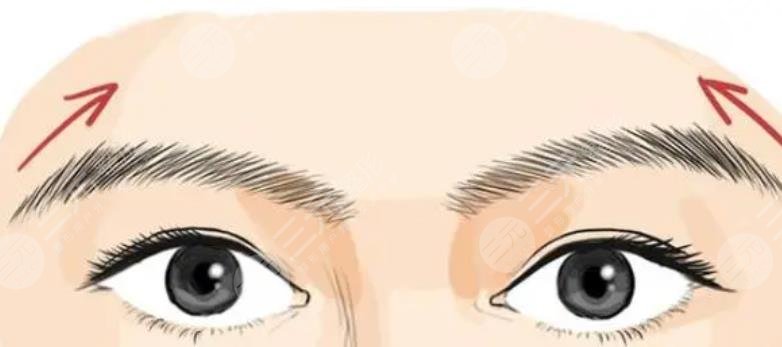 種植眉毛