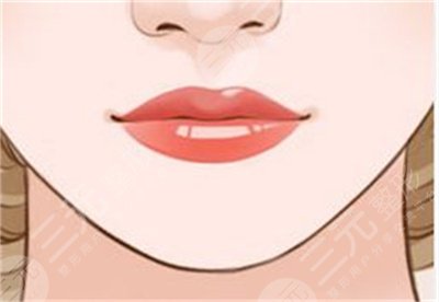 北京華真堂醫(yī)療整形注射豐唇案例