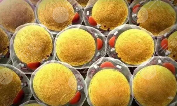 脂肪膠和自體脂肪區(qū)