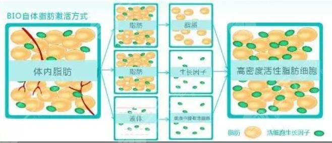 脂肪膠和自體脂肪區(qū)