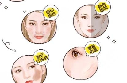 超激光美膚激光美白