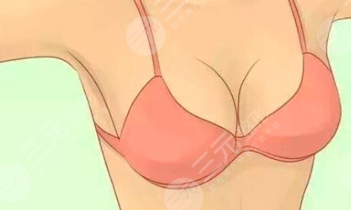 棉花糖隆胸真的不疼嗎？可信嗎？棉花糖隆胸案例術(shù)后：S曲線爆美！