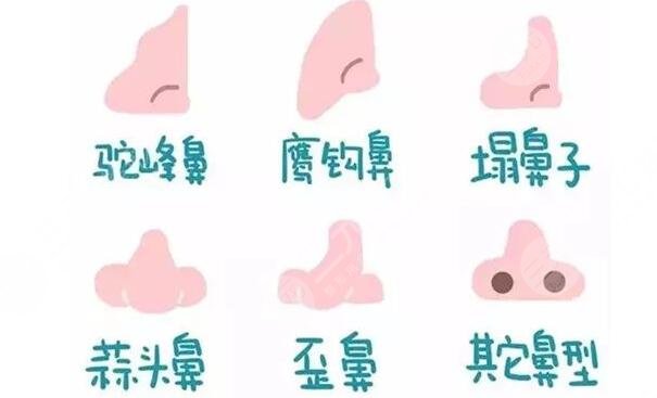 北京世紀(jì)壇醫(yī)院整形外科隆鼻案例