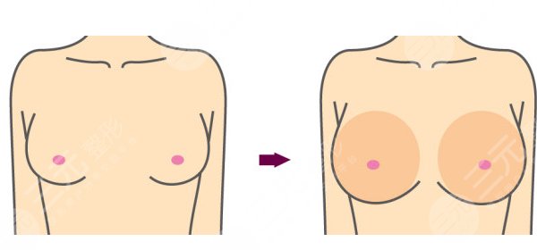 魔滴和曼托怎么選擇？魔滴和曼托的區(qū)別有哪些？