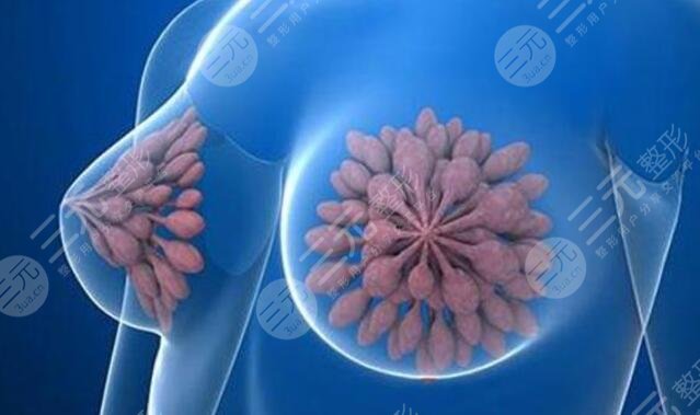 棒棒糖縮胸手術(shù)疤痕多久可以恢復(fù)？手術(shù)優(yōu)缺點(diǎn)+多少天完全消腫？