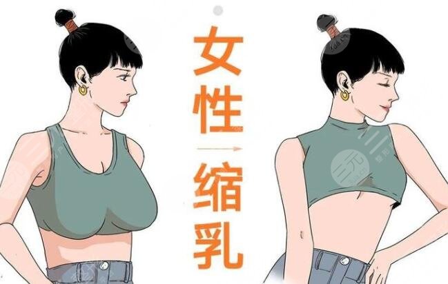 棒棒糖縮胸手術(shù)多少天完全消腫？