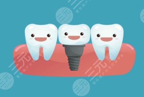 廈門(mén)市口腔醫(yī)院種植牙手術(shù)經(jīng)歷分享