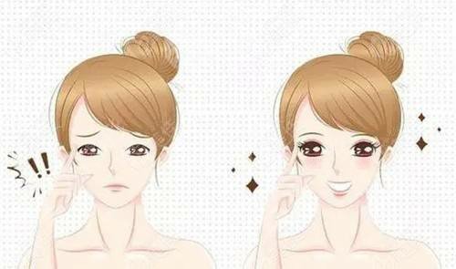 深圳因美整形醫(yī)院雙眼皮案例