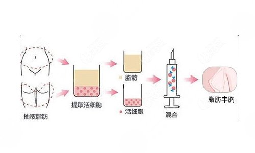 成都西區(qū)醫(yī)院整形科熱門項(xiàng)目科普