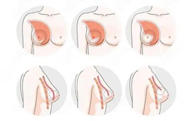 c罩杯算大胸還是小胸