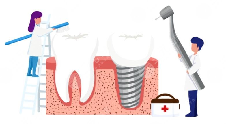 牙齒種植體十大排名NO.3、登士伯希諾德種植體