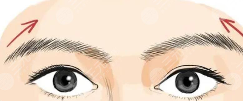 種植眉毛