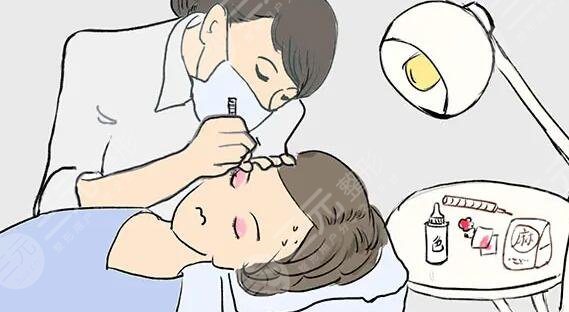 美瞳線一到七天恢復(fù)圖，網(wǎng)友：別太急著跟潮流，多了解清楚對你有好處！