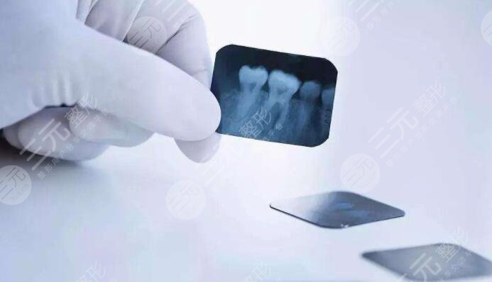 真人做牙齒矯正案例