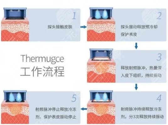 賽諾秀5D果可以維持多久？