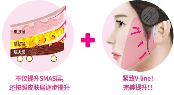 賽諾秀5D項(xiàng)目術(shù)后注意