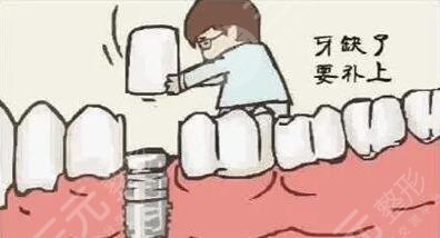 種植牙項目注意事項