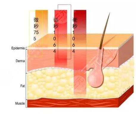賽諾秀5d膠原光的術(shù)后注意事項(xiàng)：