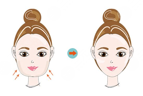 圓臉怎么變瓜子臉