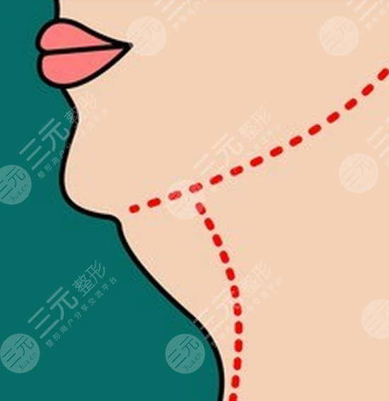 如何減去雙下巴