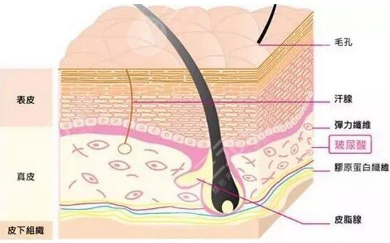 美白祛斑和玻尿酸填充哪個(gè)好？2者應(yīng)該怎么選？注意事項(xiàng)有哪些呢？