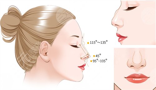 如何能讓自己的鼻子變高變挺 鼻子整形手術(shù)會有什么后遺癥 鼻子整形手術(shù)的后遺癥有哪些是什么