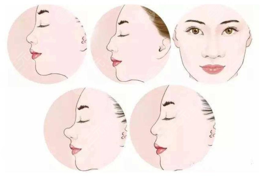 番禺中心醫(yī)院整形科特色項(xiàng)目