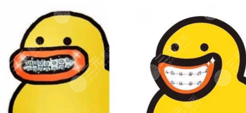 番禺中心醫(yī)院正畸案例