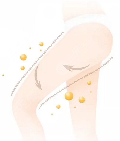 打注射瘦腿多少錢？多少錢一針比較合適？