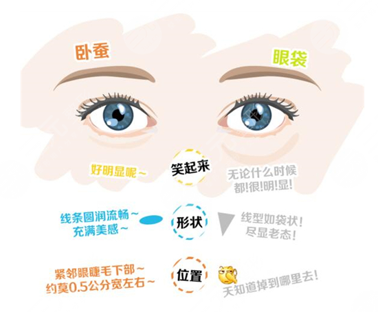 玻尿酸填充臥蠶前后對比