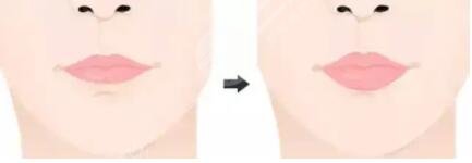 紋唇一到七天恢復(fù)圖片