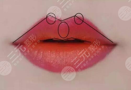 紋唇術(shù)后注意事項(xiàng)