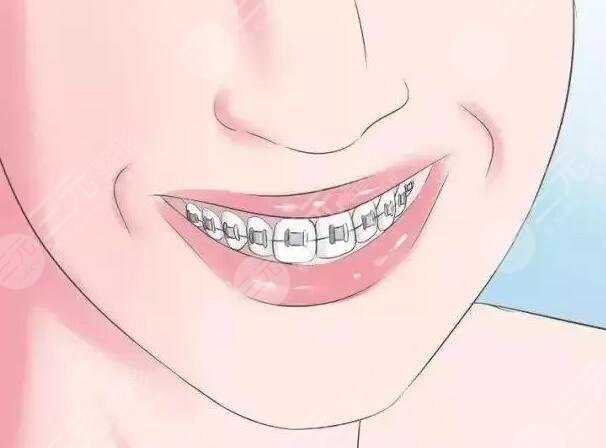 北京大學(xué)深圳醫(yī)院正畸案例