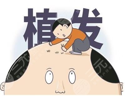 杭州三院植發(fā)案例