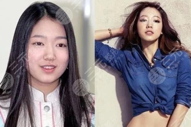 樸信惠整容前后照片